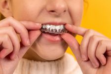 Are students too old for braces?