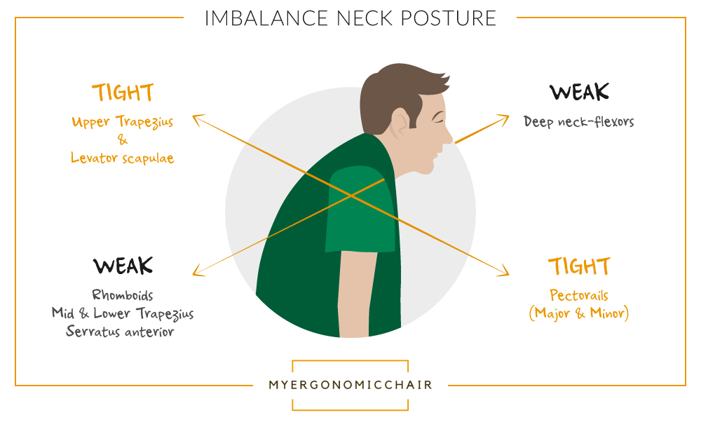 Demonstration of effects of poor posture